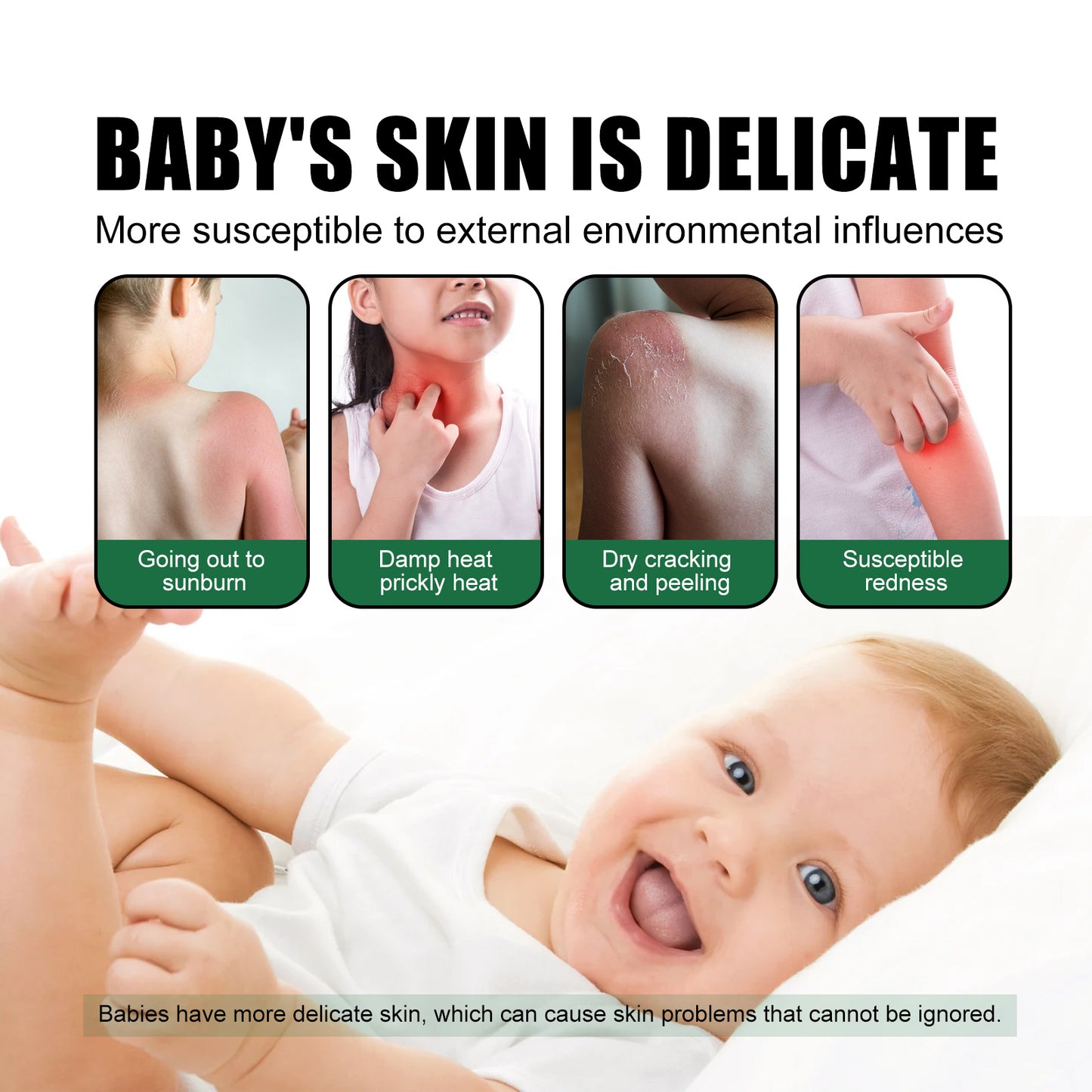 Baby Ultraviolet Rays & Outdoor Sun-Proof Spray