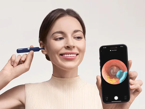 Bebird I35R Visual Ear Cleaner