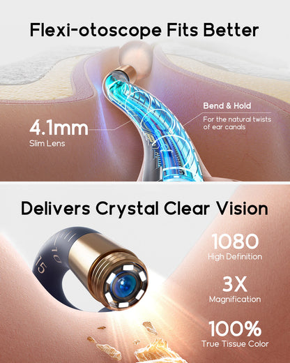 Bebird I35R Visual Ear Cleaner